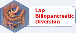 Lap Biliopancreatic Diversion