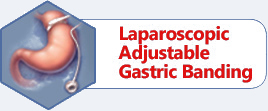 Laparoscopic Adjustable Gastric Banding