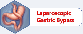 Laparoscopic Gastric Bypass