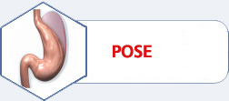 POSE (Primary Obesity Surgery Endoscopic)